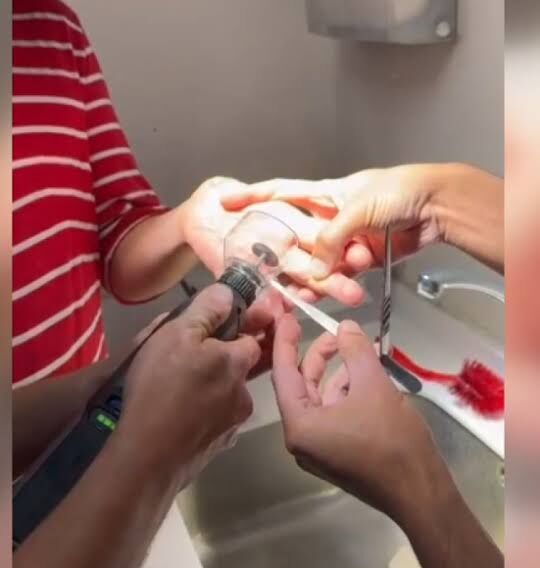 Adana'da Parmağına Sıkışan Yüzüğü İtfaiye Hastanede Çıkardı