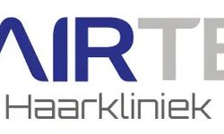 Haartransplantatie Voor en Na: Het Verschil Dat Je Ziet