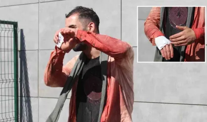 '13 Dakikada Kurbanı Keserim' Diyen Acemi Kasap Kendini Kesti