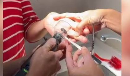 Adana'da Parmağına Sıkışan Yüzüğü İtfaiye Hastanede Çıkardı