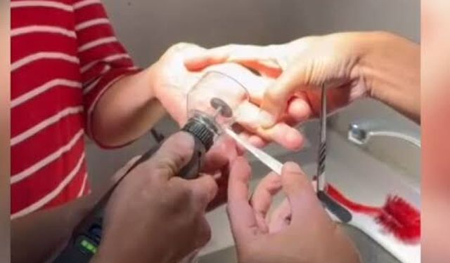 Adana'da Parmağına Sıkışan Yüzüğü İtfaiye Hastanede Çıkardı