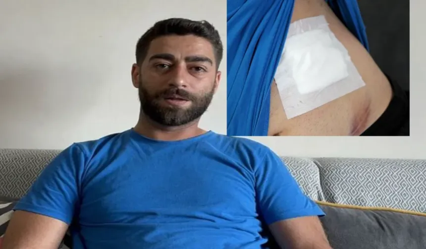 Adana’da Bayram Sessizliğinde Sessiz Bir Kurşun: Resim Öğretmeni Hobi Bahçesinde Yorgun Mermiyle Yaralandı