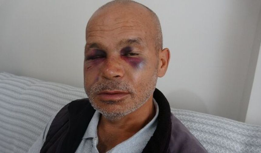 Kozan’da İşitme Engelli Adamı Tekme Ve Yumruklarla Darbetti: Şüpheli Adli Kontrol Şartıyla Serbest